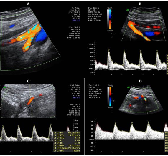 ultrassom clínica viver arterial com doppler